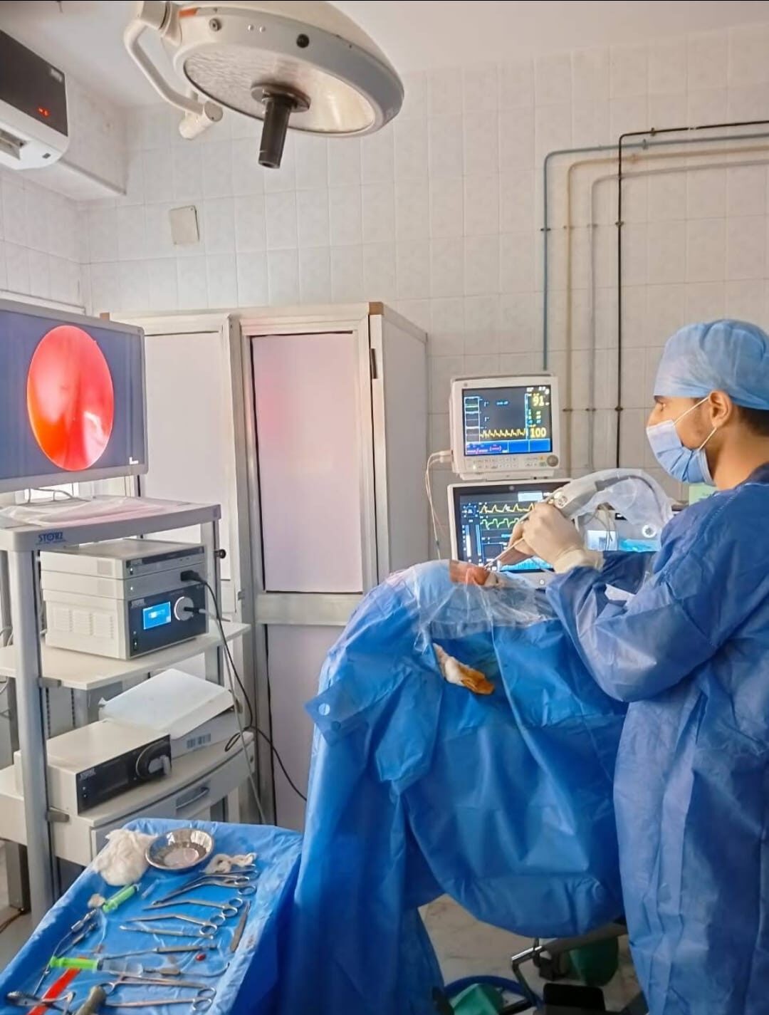 تنظيف الجيوب الأنفية بالمنظار