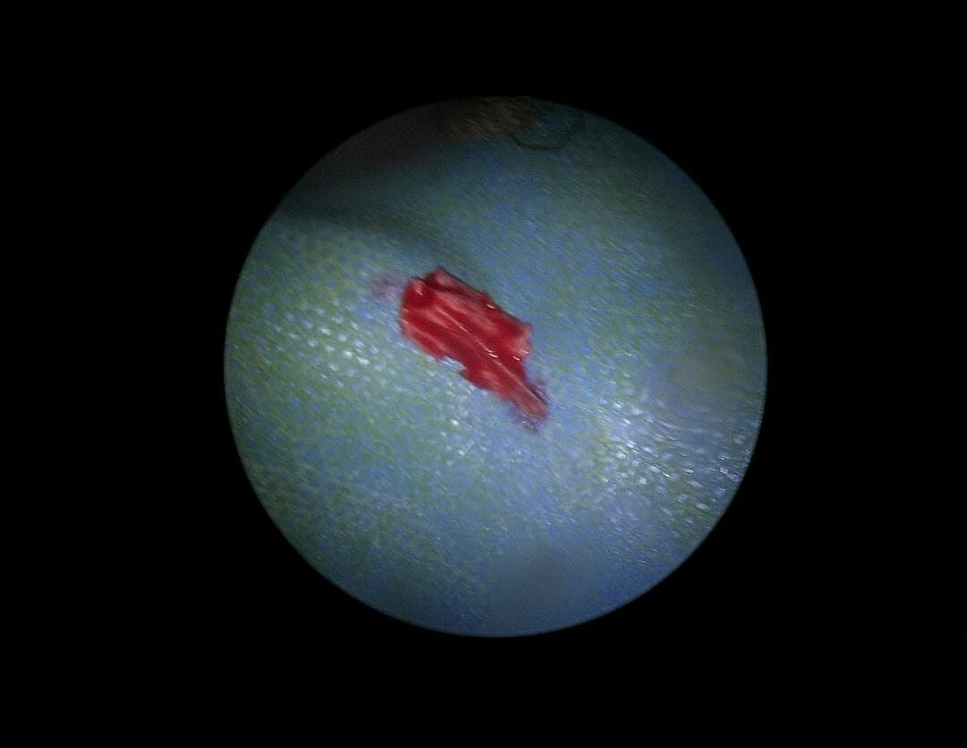 جراحة الأنف