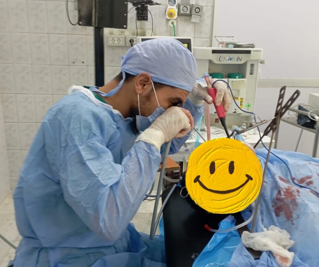 استئصال اللوزتين